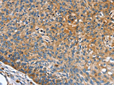 INS Antibody