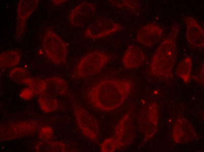 Phospho-RELA (Ser468) Antibody
