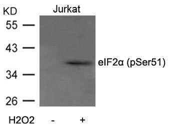 Phospho-EIF2S1 (Ser51) Antibody