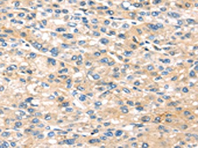 THBS2 Antibody