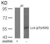 Phospho-LCK (Tyr505) Antibody
