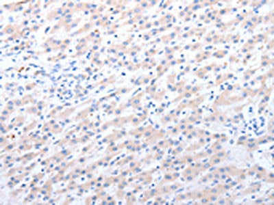 ALDH1A1/ALDH1A2/ALDH1A3 Antibody