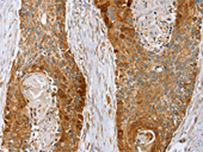 LMO4 Antibody