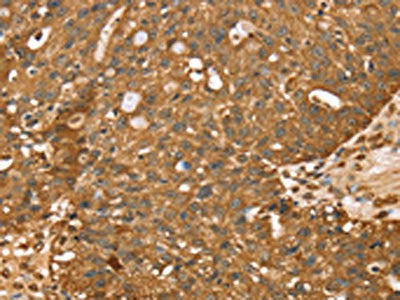 STARD5 Antibody