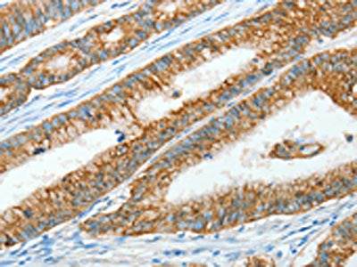 AGR3 Antibody