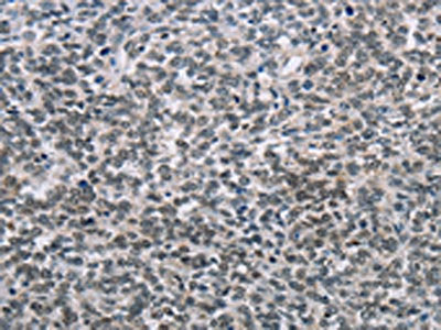 TONSL Antibody