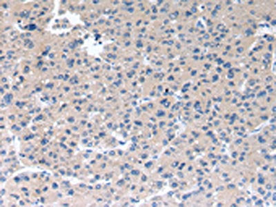RAB2A Antibody