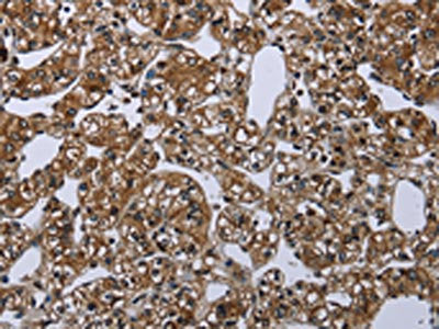 ME1 Antibody
