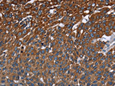 FCGR3A Antibody