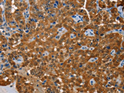 ACY1 Antibody