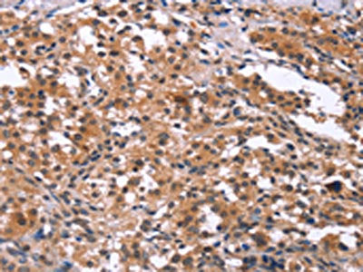GCKR Antibody