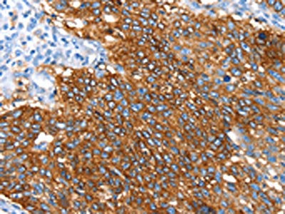 SNX5 Antibody