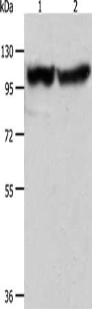 ACTN3 Antibody