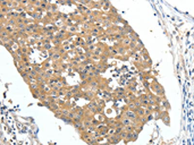 FSHR Antibody