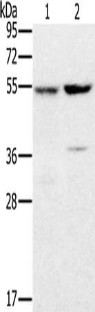 PPM1F Antibody