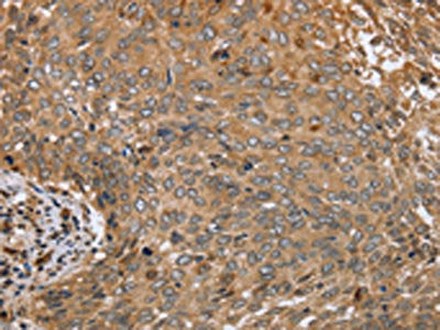 CLEC16A Antibody
