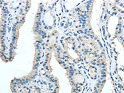 TRIB1 Antibody
