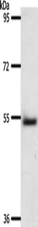 A1BG Antibody