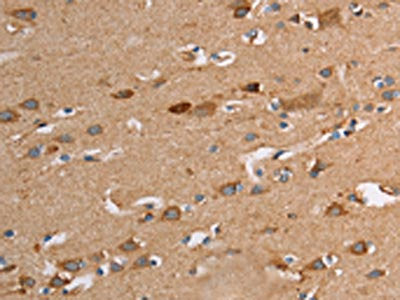 TLR8 Antibody