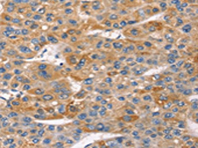SNTA1 Antibody