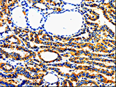 AIMP2 Antibody