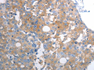 SLC12A6 Antibody