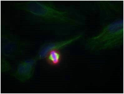 Phospho-Histone H3.1 (Ser10) Antibody