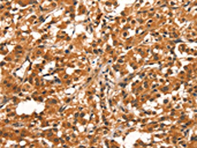 CYP2B6 Antibody