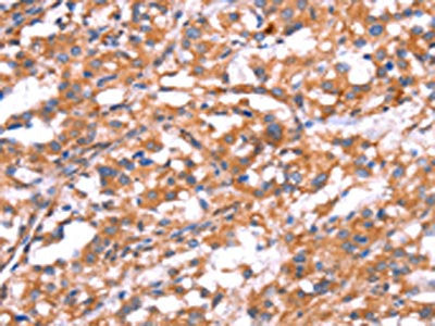 GABBR1 Antibody