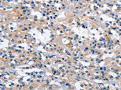 GAS2 Antibody