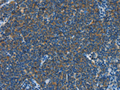 CNTNAP3 Antibody