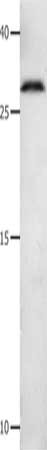 MMP7 Antibody