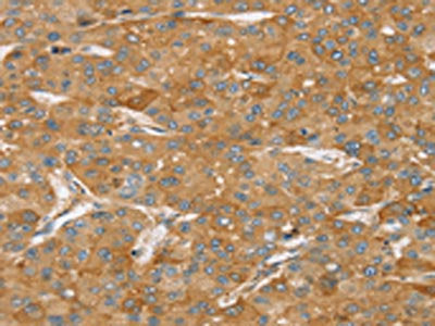 TPD52L2 Antibody