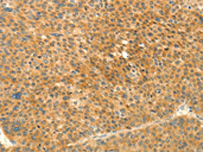 PRKACG Antibody