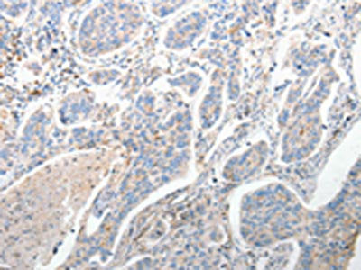 FOXD1 Antibody