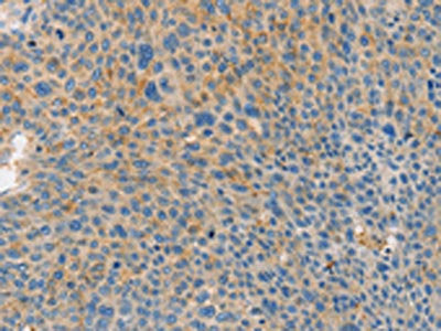 BRCA1 Antibody