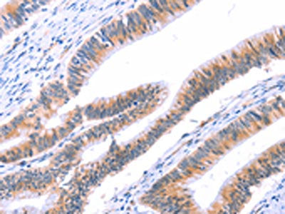 VWF Antibody
