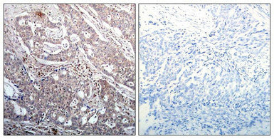 Phospho-NFKBIB (Ser23) Antibody