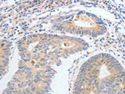 CALCR Antibody