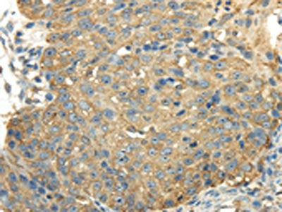 PKM Antibody