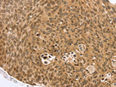 VMP1 Antibody