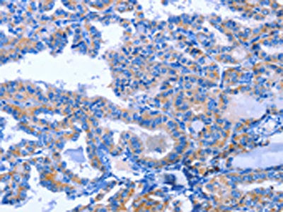 ACVR2B Antibody