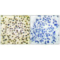 FOS Antibody