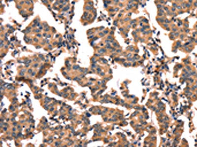 CGA Antibody