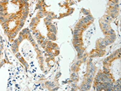 SELM Antibody