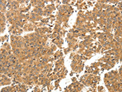 LYZ Antibody