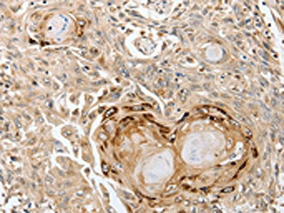 SLC1A7 Antibody