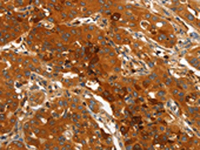 ORM2 Antibody
