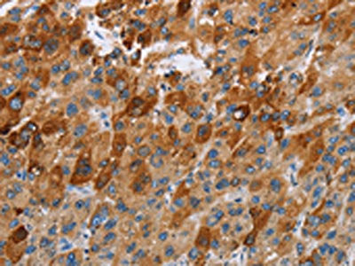 CCR9 Antibody