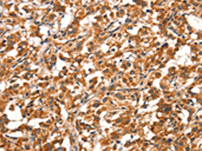 DDAH2 Antibody